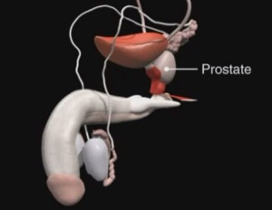 Prostate Health - What is Prostate Enlargement (BPH)
