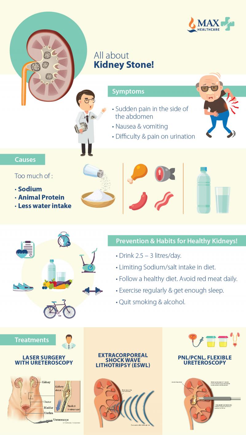 Everything You Need to Know About Kidney Stones