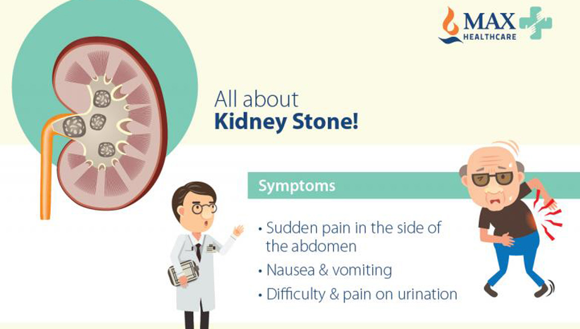 Image result for Winning Over Kidney Stones infographics