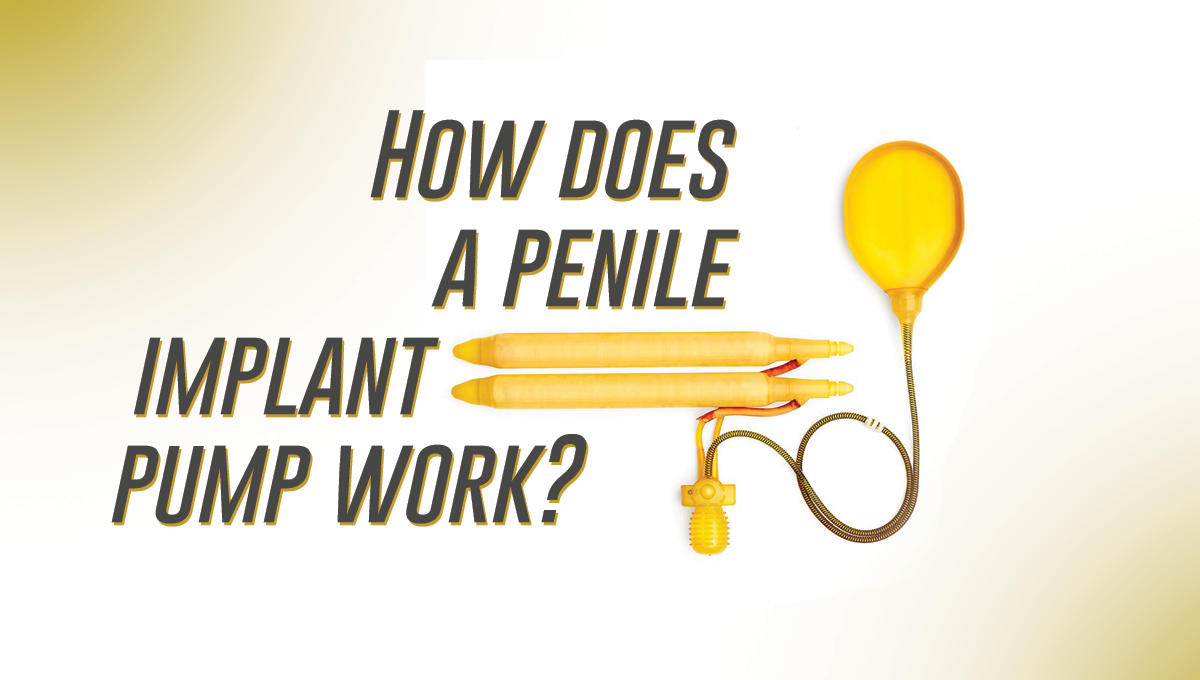 To use pump penile how a 