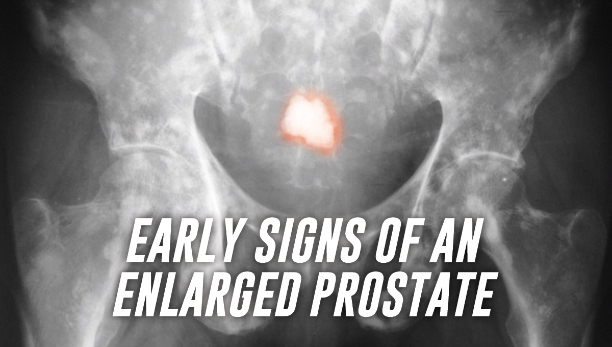 News Archives St Pete Urology