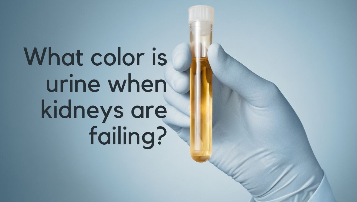 What color is urine when kidneys are failing?