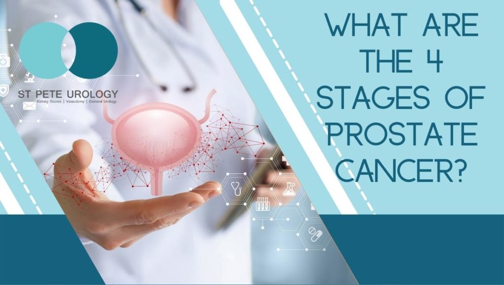 Forgotten Facts About Prostate Cancer | St Pete Urology