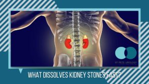 What dissolves kidney stones fast?