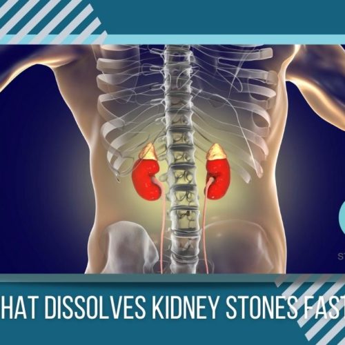 What color is healthy for urine? St Pete Urology