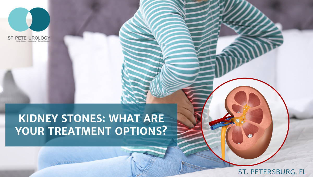 Kidney stones: What are your treatment options?