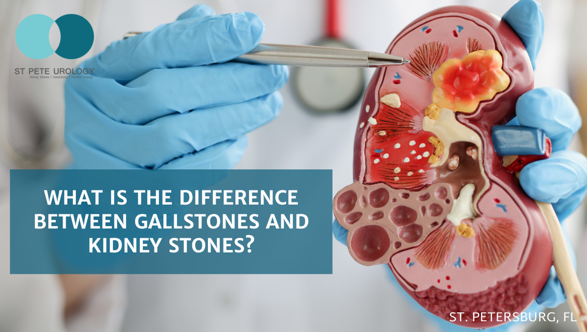 What is the Difference Between Gallstones and Kidney Stones?