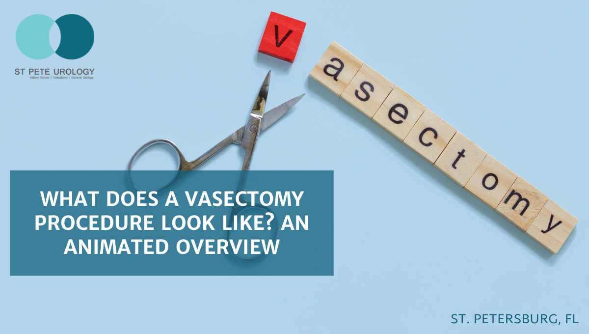What Does a Vasectomy Procedure Look Like? An Animated Overview